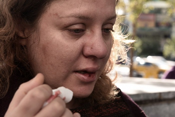 Njerëz të Agimit të Artë rrahin avokaten e emigrantëve në greqi (PAMJE TË RËNDA)