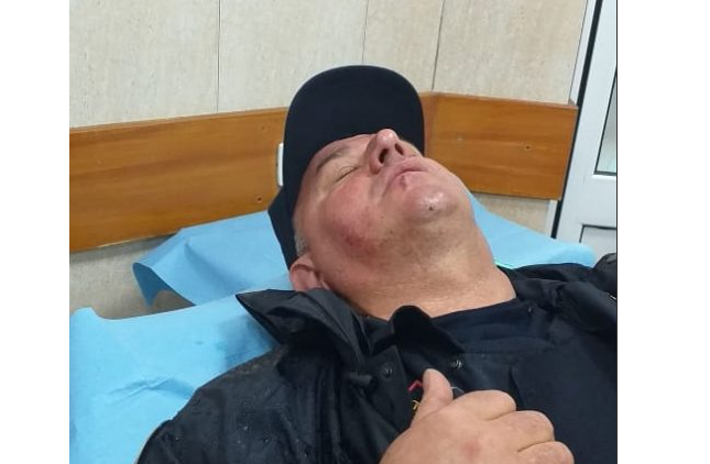 Protesta, lëndohen dy policë nga kapsollat e militantëve të opozitës (FOTO)