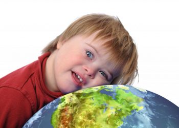 Një studim i ri jep shpresë: Sindroma Down mund të shërohet