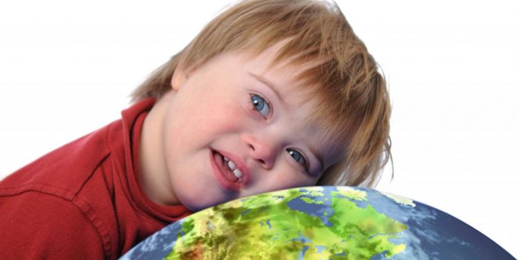 Një studim i ri jep shpresë: Sindroma Down mund të shërohet