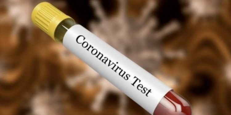 Rasti i dyshuar me koronavirus në Sarandë, del përgjigjja nga analizat