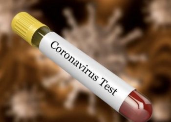 Koronavirusi: Dhjetë aryse pse nuk duhet të përjetoni panik