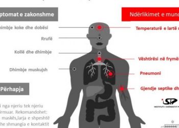 Masat kryesore, si mund ta parandaloni prekjen nga koronavirusi (Këshillat)