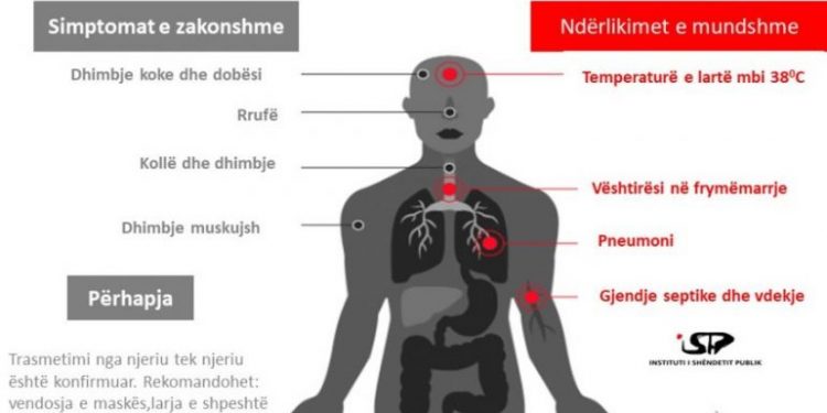 Masat kryesore, si mund ta parandaloni prekjen nga koronavirusi (Këshillat)