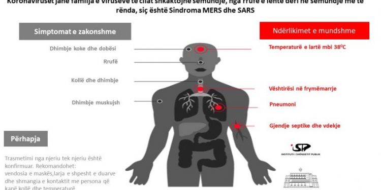 Udhëzimi i plotë i ISHP/ Çfarë është Koronavirusi dhe si mund të mbrohemi