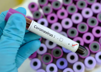 Si të kuptoni nëse jeni prekur nga koronavirusi apo jo? Pamje që duhet t’i shihni dhe shpërndani të gjithë (VIDEO)