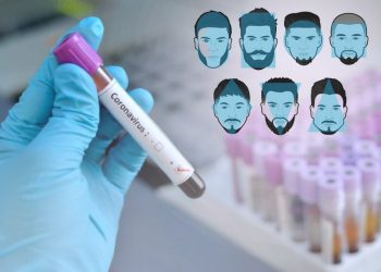 Pse njerëzit me mjekërr janë më të rrezikuar nga Koronavirusi