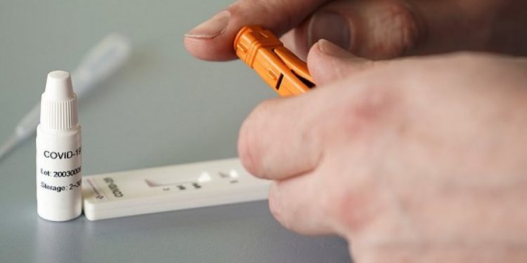 Testet e koronavirusit/ Nga ndryshojnë dhe cili është më i saktë?