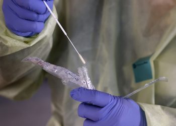 Një test i rrezikshëm dhe i pavërtetë po qarkullon në mediat sociale, ja pse duhet ta shmangni atë