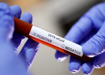 Mjeku Pëllumb Pipero ka një apel për të gjithë: Mos u panikoni, ne s’ju kemi fshehur asgjë! Shifrat do rriten po ju mos u trembni