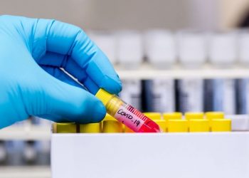 OBSH ka një njoftim të rëndësishëm për Shqipërinë: Ja kur duhet bërë testi për koronavirusin