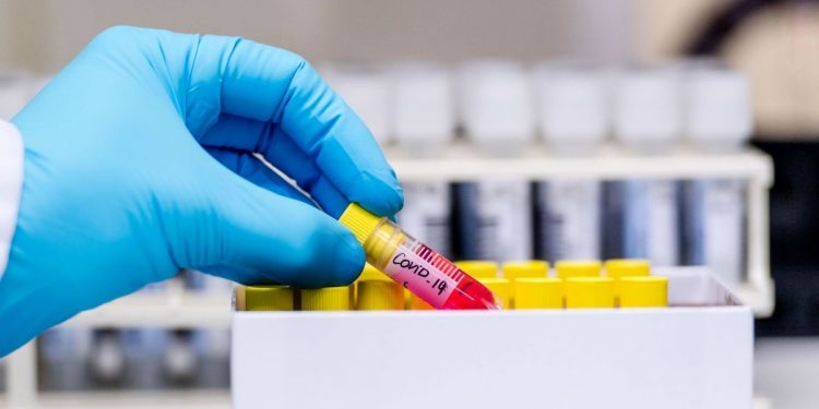 OBSH ka një njoftim të rëndësishëm për Shqipërinë: Ja kur duhet bërë testi për koronavirusin