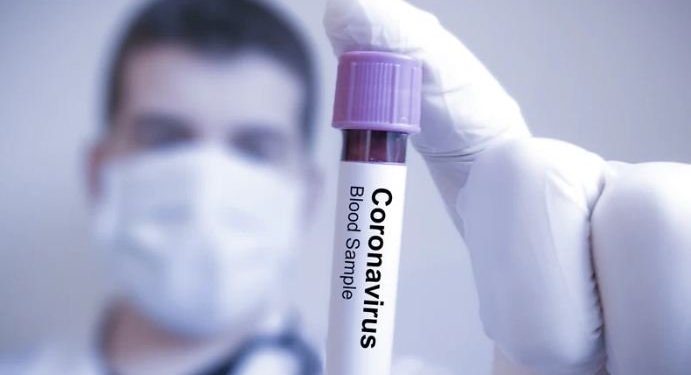 Me RËNDËSI/ Ky është ilaçi i vetëm që deri më tani lufton koronavirusin