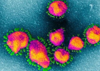 Vëzhgimet e reja, ja çfarë i bën trupit tonë Koronavirusi