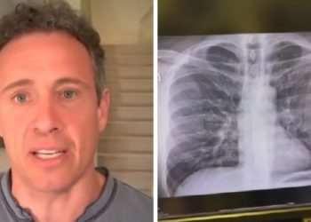 Gazetari i CNN tregon sekretin e mposhtjes së koronavirusit pa shkuar në spital (VIDEO)