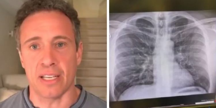 Gazetari i CNN tregon sekretin e mposhtjes së koronavirusit pa shkuar në spital (VIDEO)