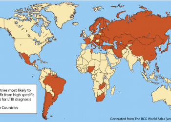 Pse vendet që kanë aplikuar vaksinën e tuberkulozit (si Shqipëria) janë më imune ndaj koronavirusit
