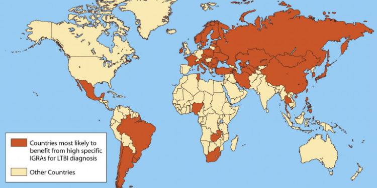 Pse vendet që kanë aplikuar vaksinën e tuberkulozit (si Shqipëria) janë më imune ndaj koronavirusit