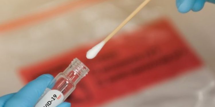 Kujdes, Covid dëmton dhe meshkujt në testikuj