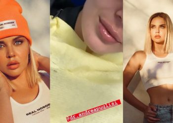 Kejvina Kthella zmadhon buzët, e pranon vetë: I preka pak!