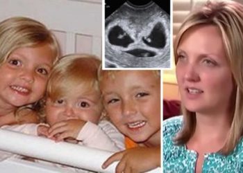 Mrekulli! Humbën tre fëmijët në aksident, pas një viti Zoti bekon çiftin më trenjakë