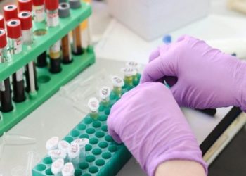 Del testi i ri, Covid identifikohet edhe nëpërmjet gjakut