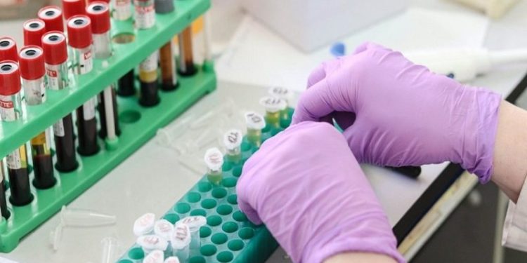 Del testi i ri, Covid identifikohet edhe nëpërmjet gjakut