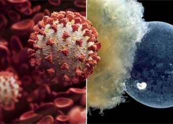 Studimi/Ja si ndikon COVID te nënat shtatëzanë dhe embrioni