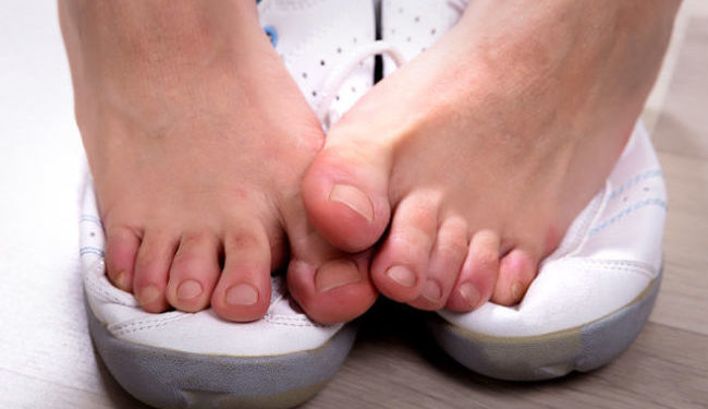 4 mënyra për të parandaluar djersitjen e këmbëve