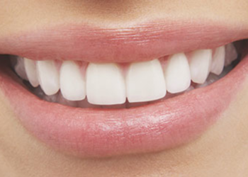 5 hilet e make up -it për të patur dhëmbë të bardhë