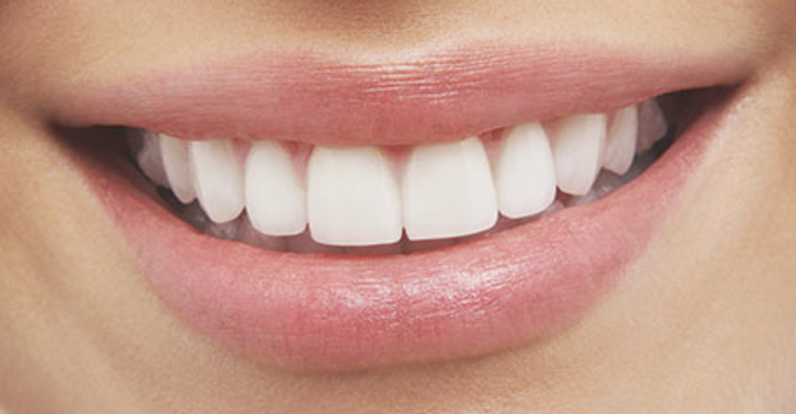 5 hilet e make up -it për të patur dhëmbë të bardhë