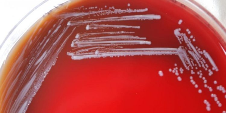 Gafë e rëndë në Kinë, bakteri i rrezikshëm del nga laboratori, infektohen mijëra njerëz