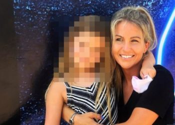 Përdori dezinfektant për t’u mbrojtur nga Covid-19, gruaja pëson djegie të rënda në trup (FOTO)