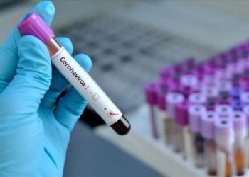 Katër të vdekur dhe 55 raste të reja me Covid-19 në Kosovë