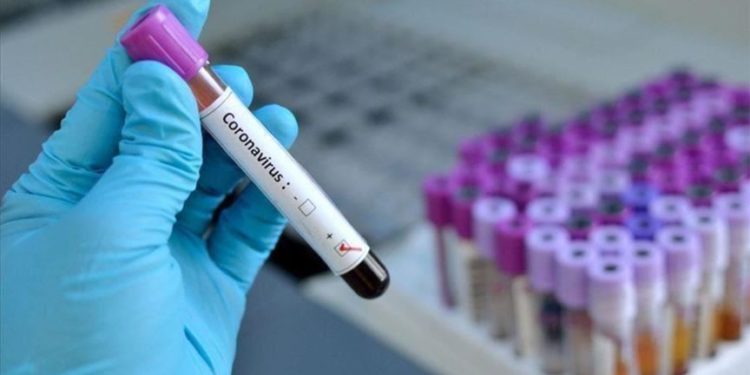 Katër të vdekur dhe 55 raste të reja me Covid-19 në Kosovë