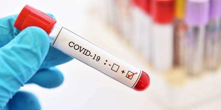 Alarmi i Covid në Paris, mbi 17% e testeve të kryera rezultojnë pozitivë