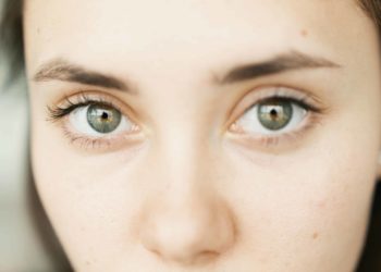 4 gabimet që shkaktojnë rrathë poshtë syve