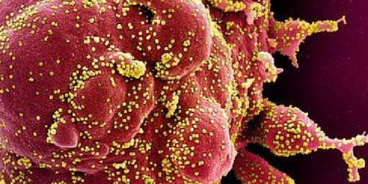 Gjenden super anti-trupat që bllokojnë sulmin e COVID-19 në qelizat e njeriut