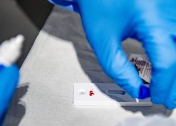 Studimi për Covid-19: Antitrupat zgjasin më shumë te gratë se te burrat