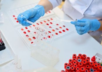 Grupet e gjakut më rezistentë ndaj Covid-19