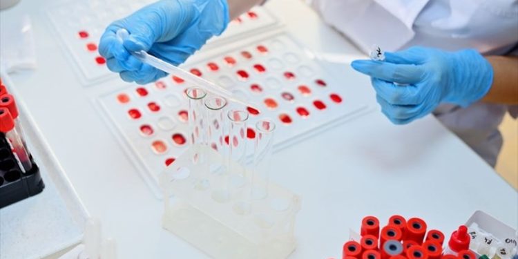 Grupet e gjakut më rezistentë ndaj Covid-19