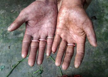 Njihuni me burrat e familjes që nuk kanë shenja gishtash (FOTO)