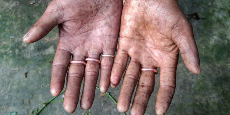 Njihuni me burrat e familjes që nuk kanë shenja gishtash (FOTO)