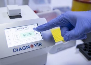 Shkencëtarët turq arrijnë të diagnosifikojnë virusin COVID-19 në 10 sekonda