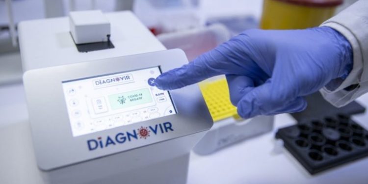 Shkencëtarët turq arrijnë të diagnosifikojnë virusin COVID-19 në 10 sekonda