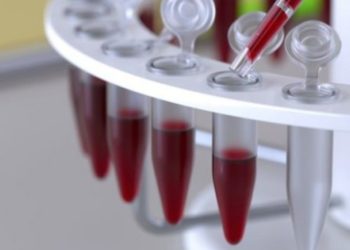 Studimi/ Testi i gjakut që tregon se cili pacient mund t’i mbijetojë virusit COVID-19