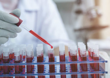 Studimi/ Njerëzit me grup gjaku 0 rrezikohen më pak nga COVID-19