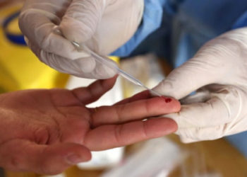 Testi i gjakut që ndihmon në parashikimin nëse një pacient i prekur nga Covid mbijeton ose jo