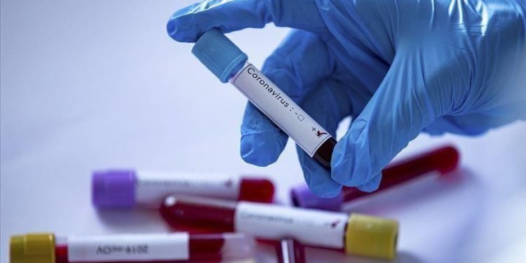 Ekspertët e OBSH-së nga 9 shtete arrijnë në Wuhan për të hetuar origjinën e Covid-19