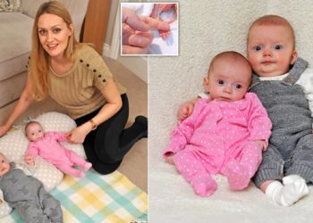 E rallë/ Nëna mbeti shtatzan dy herë brenda tre javësh. Lindi dy fëmijët me operacion